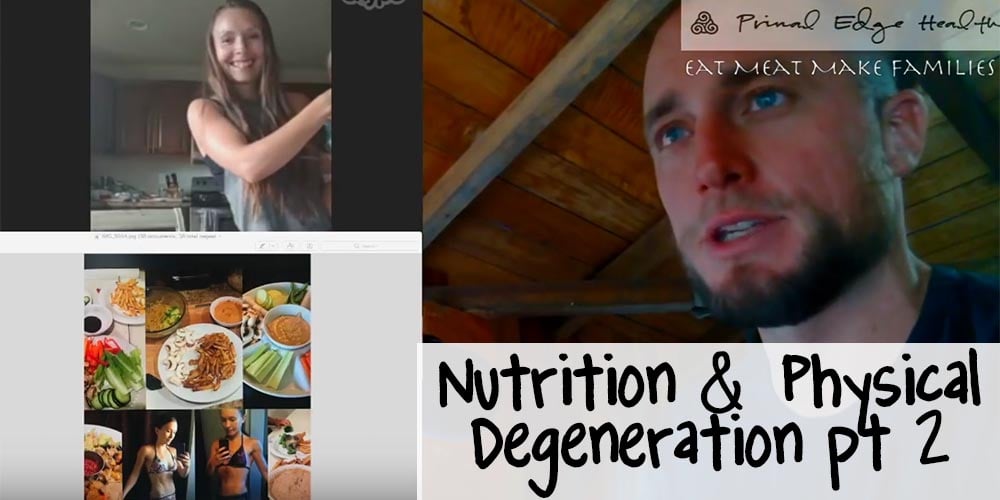 Nutrition and physical degeneration part two.