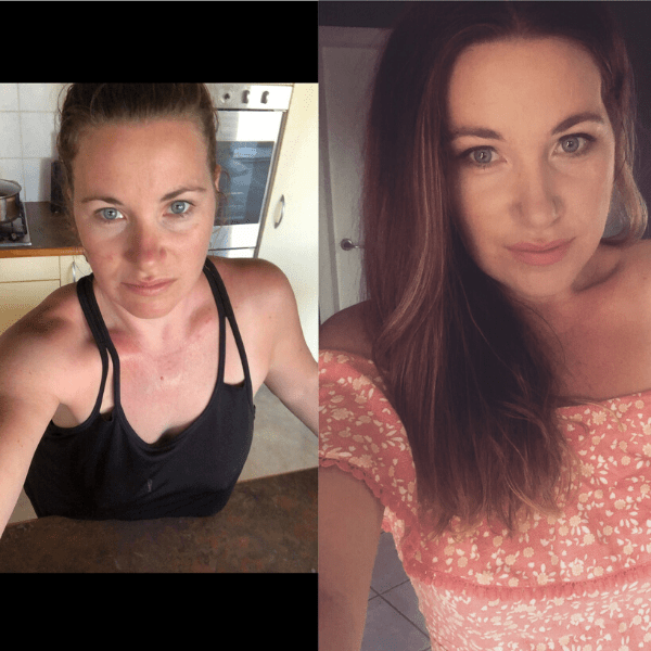 Two pictures of a woman before and after a weight loss.