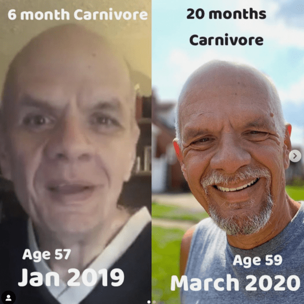 Brett before after carnivore diet results 7