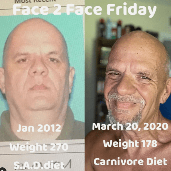 Brett before after carnivore diet results depression 3