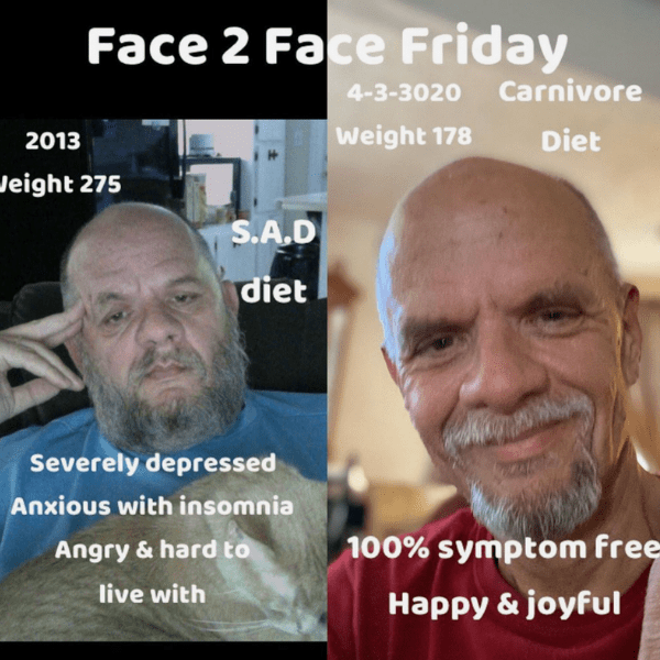 Brett before after carnivore diet results fat loss 6