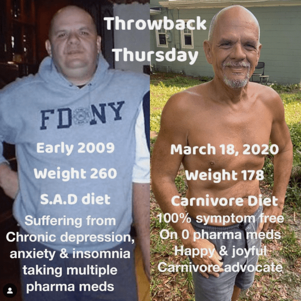 Brett before after carnivore diet results joint pain 2